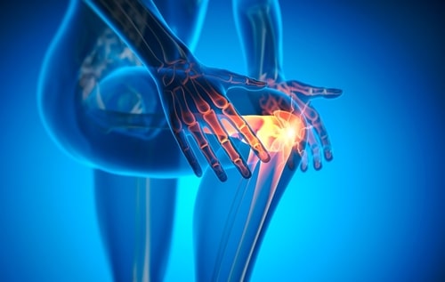 These Factors (Not the Ones You Think of) Are Associated With Worse Arthritis